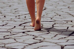summer skin dry heels